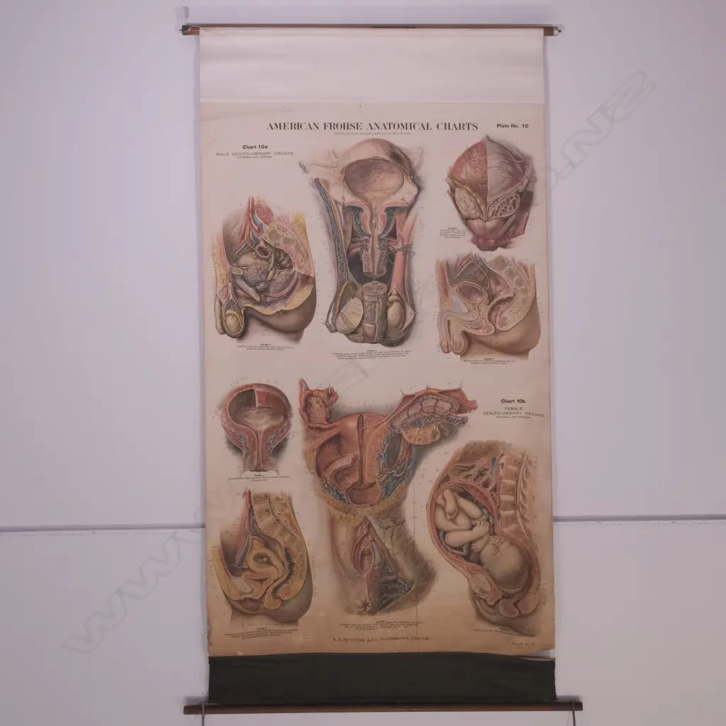 LG VINTAGE CANVAS BACKED US FROHSE ANATOMICAL CHART BY A.J. NYSTROM & CO. 1200 X 1820MM Image 1++