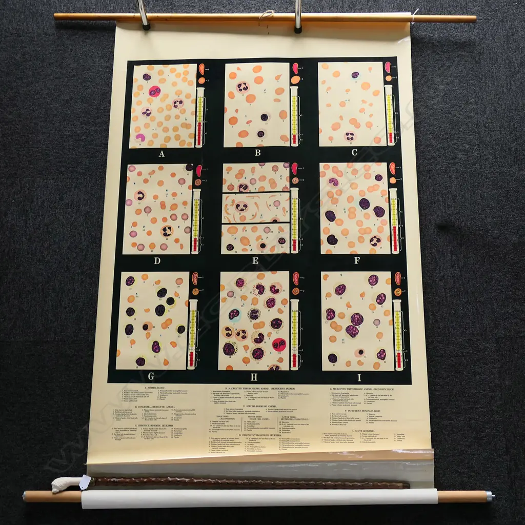 VINTAGE MEDICAL CHART, ADAM ROUILLY, DISEASES OF THE BLOOD 2000 x 940mm Image 1++