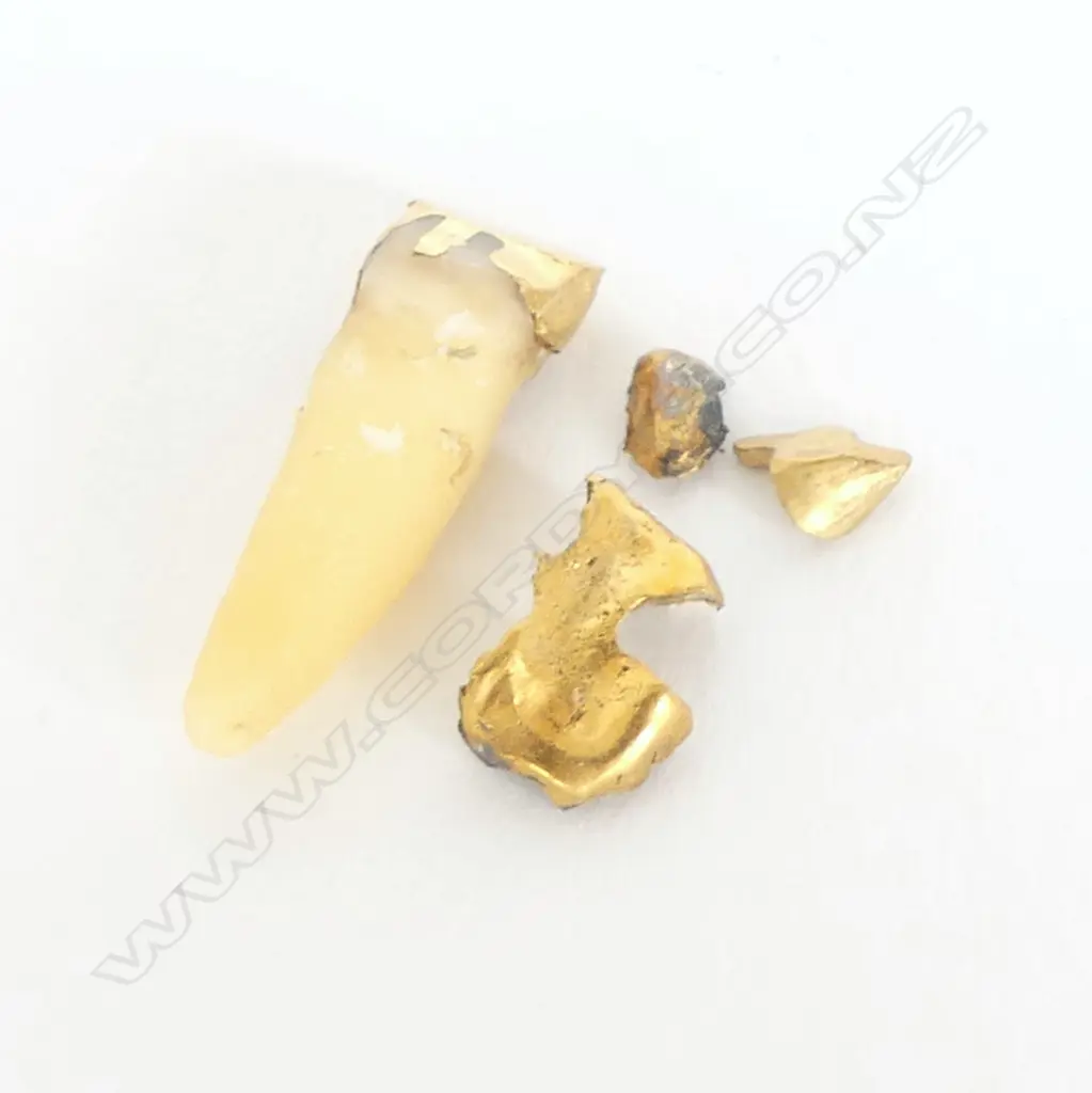 GOLD FROM TEETH & TOOTH w GOLD FILLING, 3.6gm incl tooth weight Image 1++