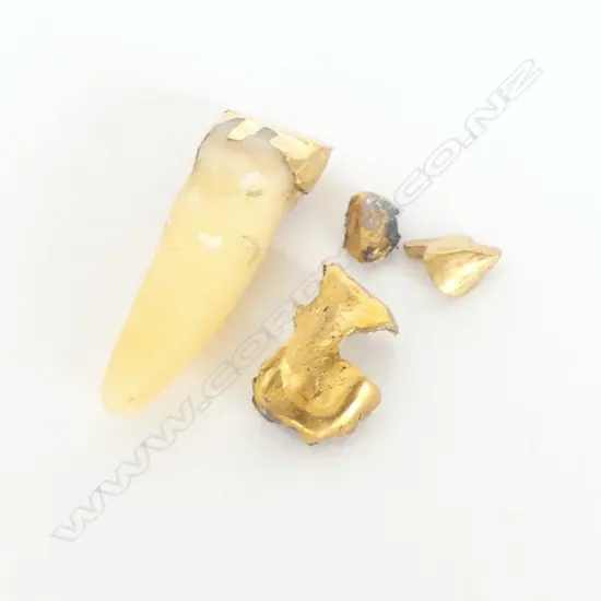 GOLD FROM TEETH & TOOTH w GOLD FILLING, 3.6gm incl tooth weight