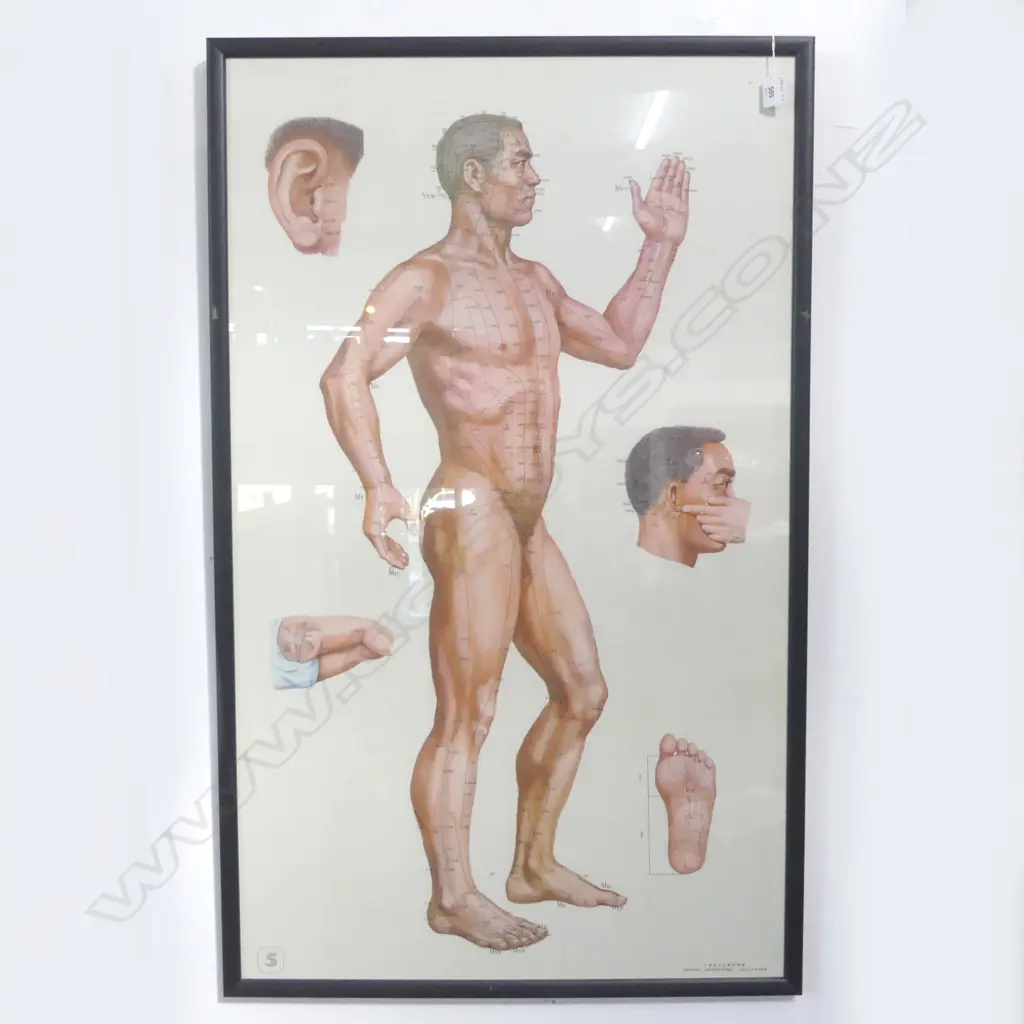 FRAMED ACCUPUNCTURE POSTER 1040x620mm Image 1++
