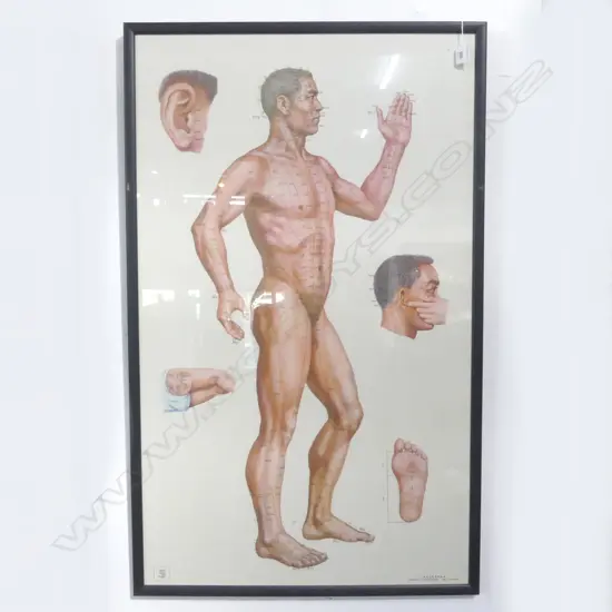 FRAMED ACCUPUNCTURE POSTER 1040x620mm