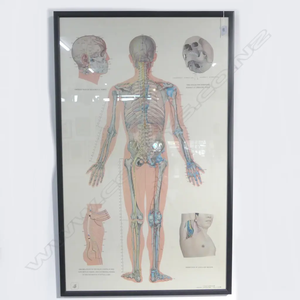 FRAMED ACCUPUNCTURE POSTER 1040x620mm Image 1++