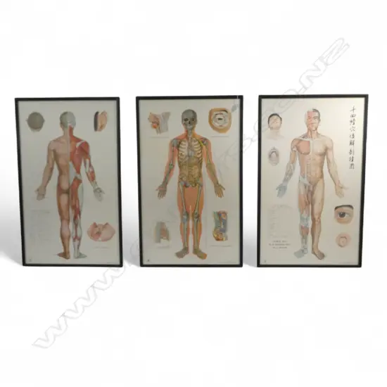 3 FRAMED ACCUPUNCTURE POSTERS (NO GLASS) 1040x620mm