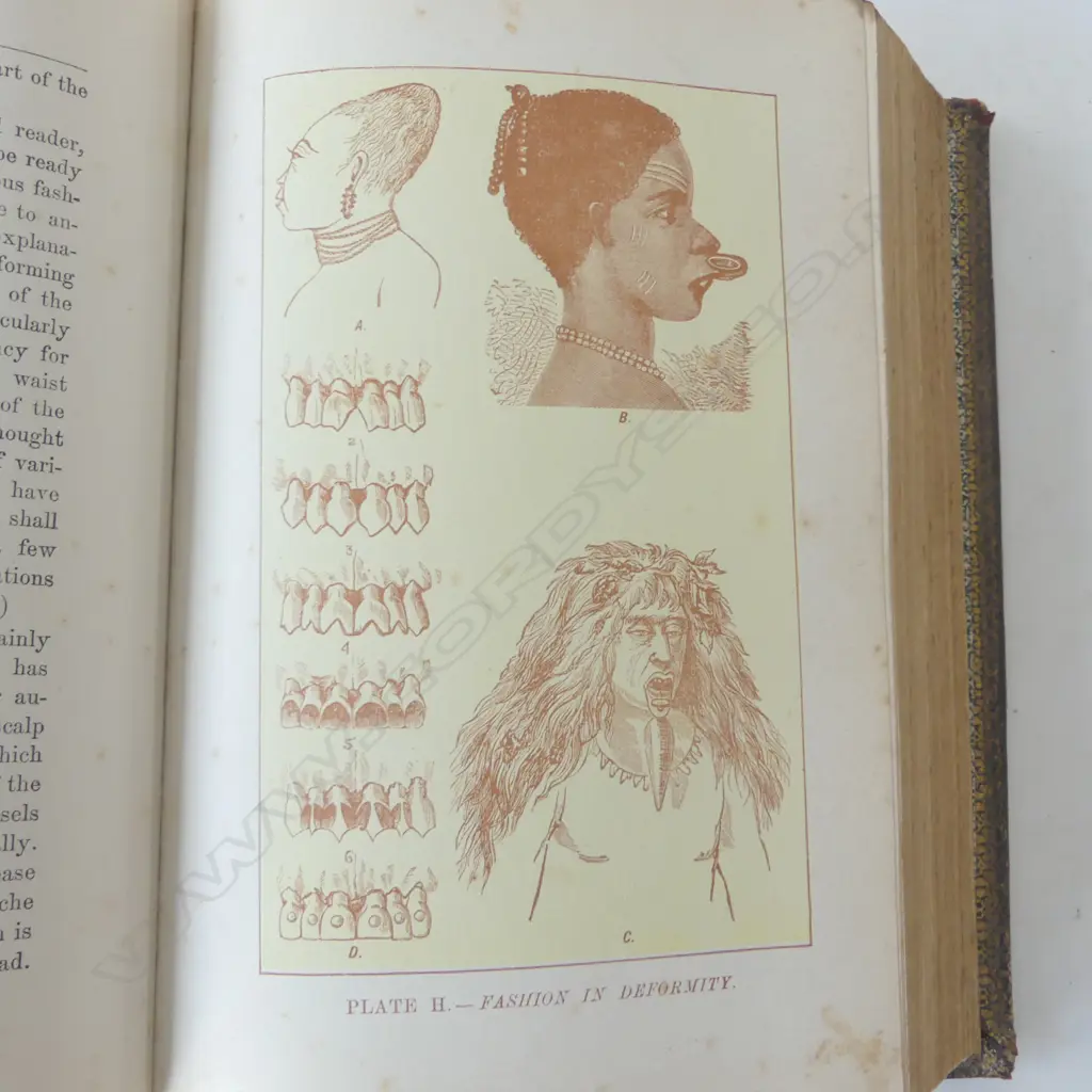 LADIES' GUIDE - HEALTH & DISEASE by J. H. KELLOGG, W. D. CONDIT & CO 1880 Image 1++